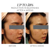 Violet Water Hydra-Gel - OSKIA - Banango Shop